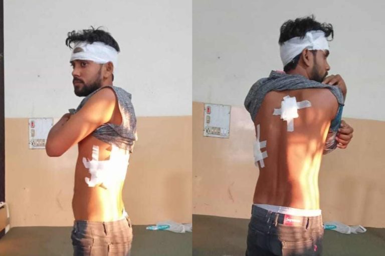 वीरगंजकाे मुर्लीमा झडप, एक समुहकाे छुरा प्रहारबाट एक जना घाइते
