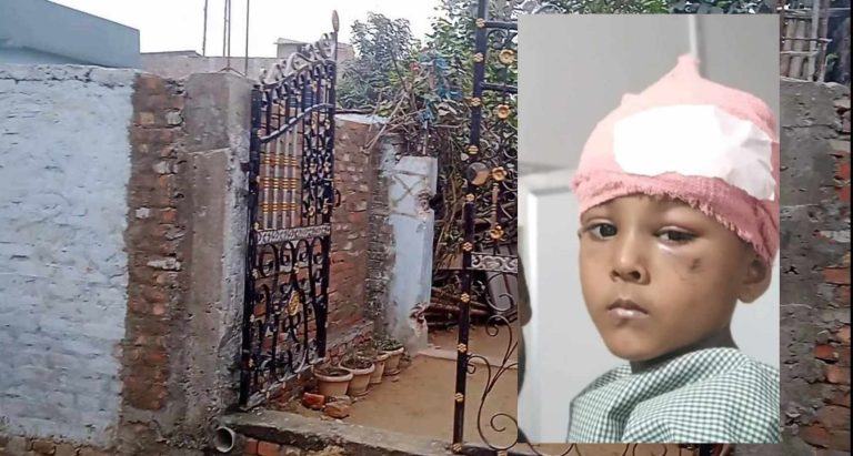 पढन गएका बिद्यार्थीलाई काममा लगाउँदा महुवनमा एक बालक घाइते