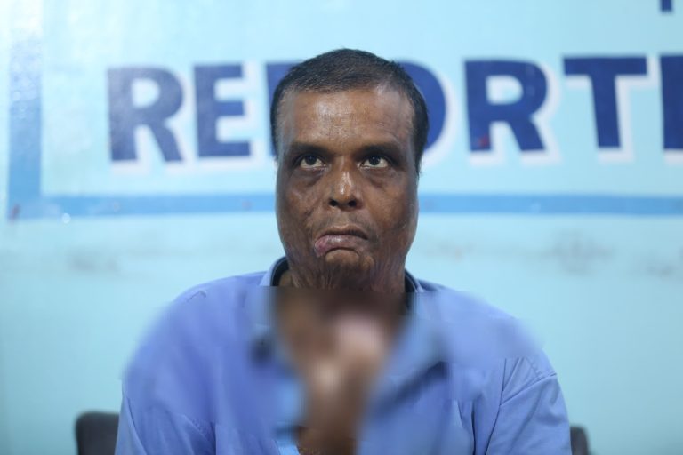 रौतहट बमकाण्डमा घाइते गौरीशंकरको गुनासो : “शरीर जलेको छ, न्याय पनि जलेको छ”